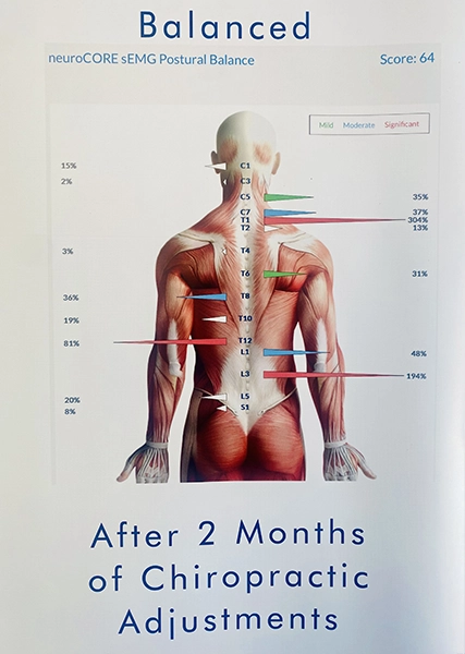 Chiropractic Springfield IL Balanced Spine