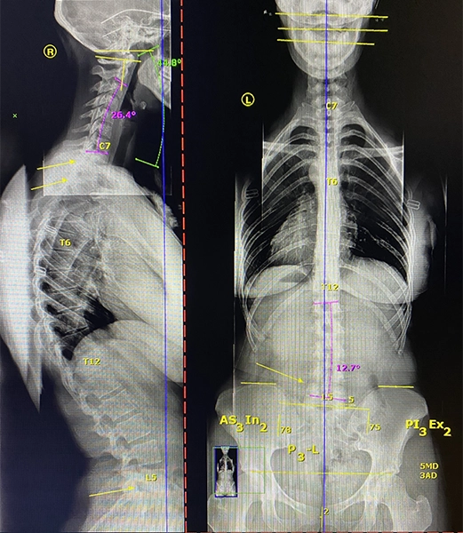 Chiropractic Springfield IL X Ray